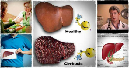 What Are The Causes And Symptoms Of Fatty Liver Disease?